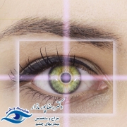 توپوگرافی چشم چیست و چه کاربردهایی دارد