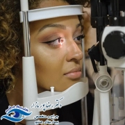 روش های نوین درمان قوز قرنیه