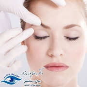 عمل زیبایی چشم چیست