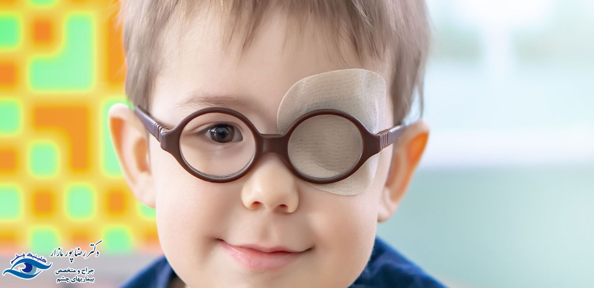 درمان تنبلی چشم چطور است